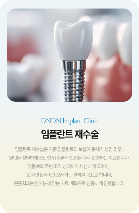 임플란트 재수술