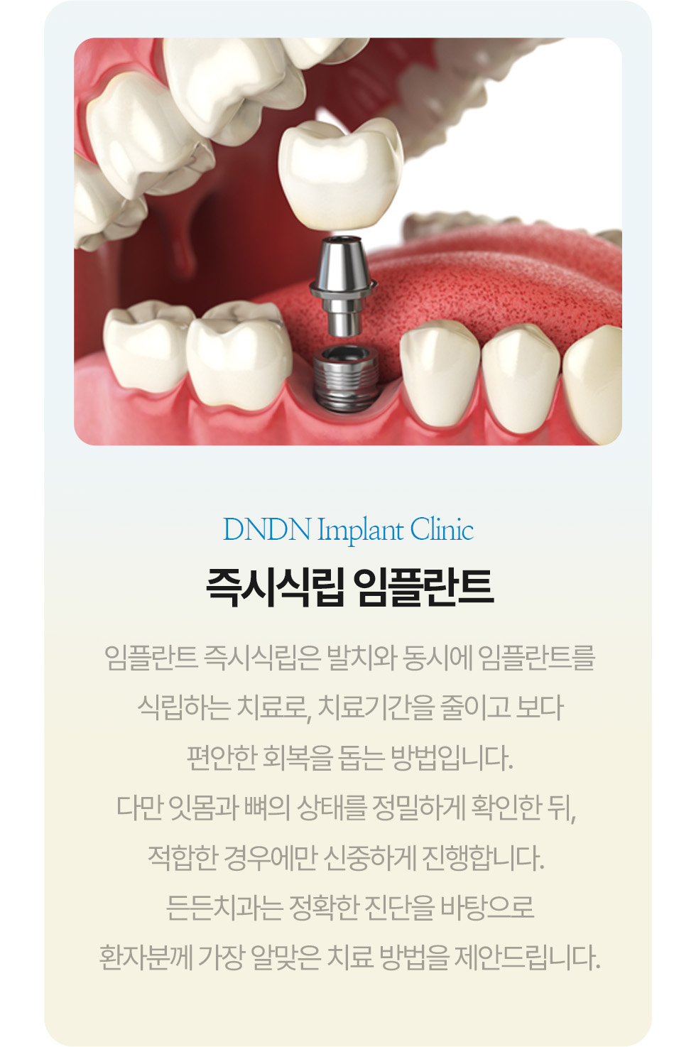 상악동 거상술