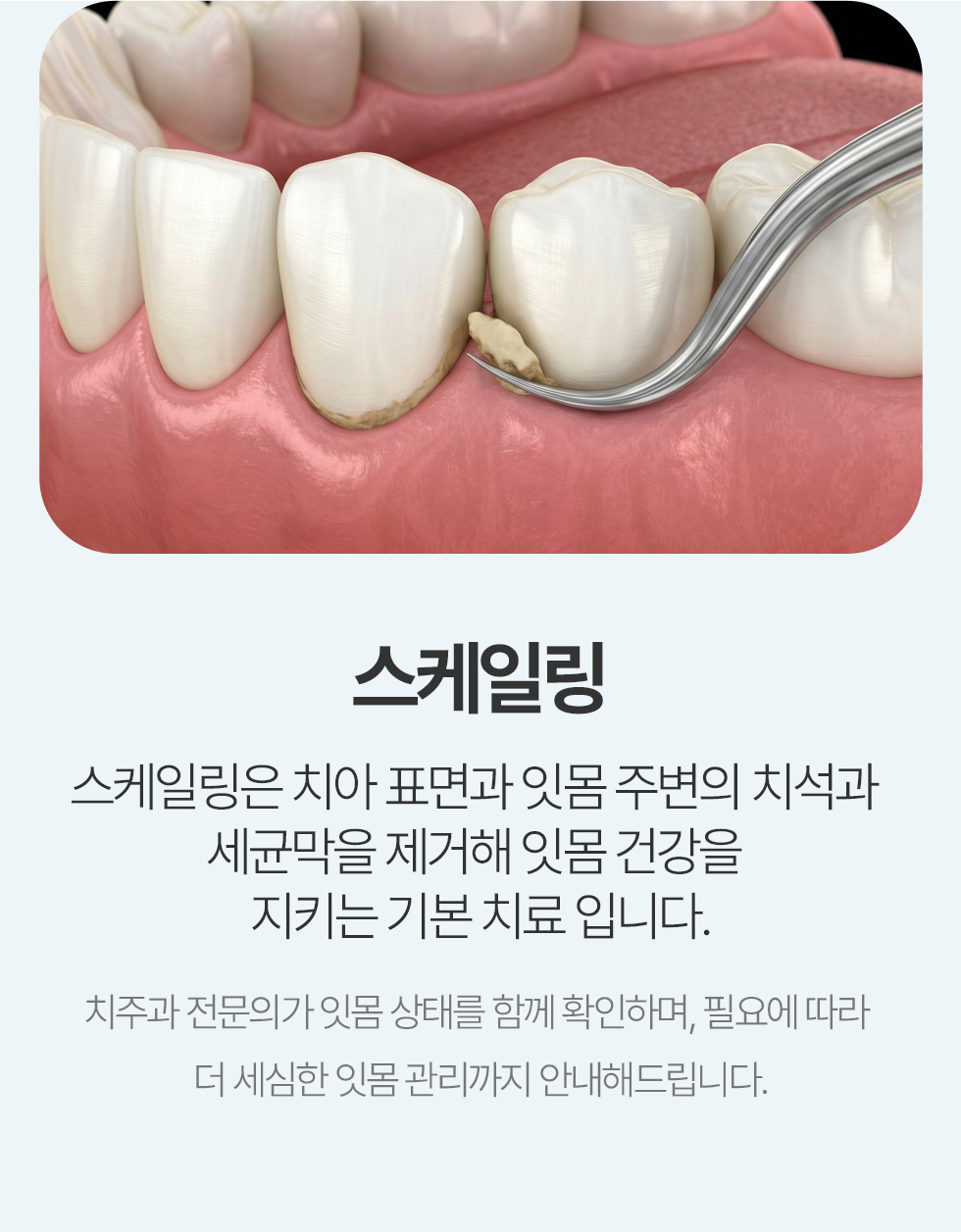 스케일링