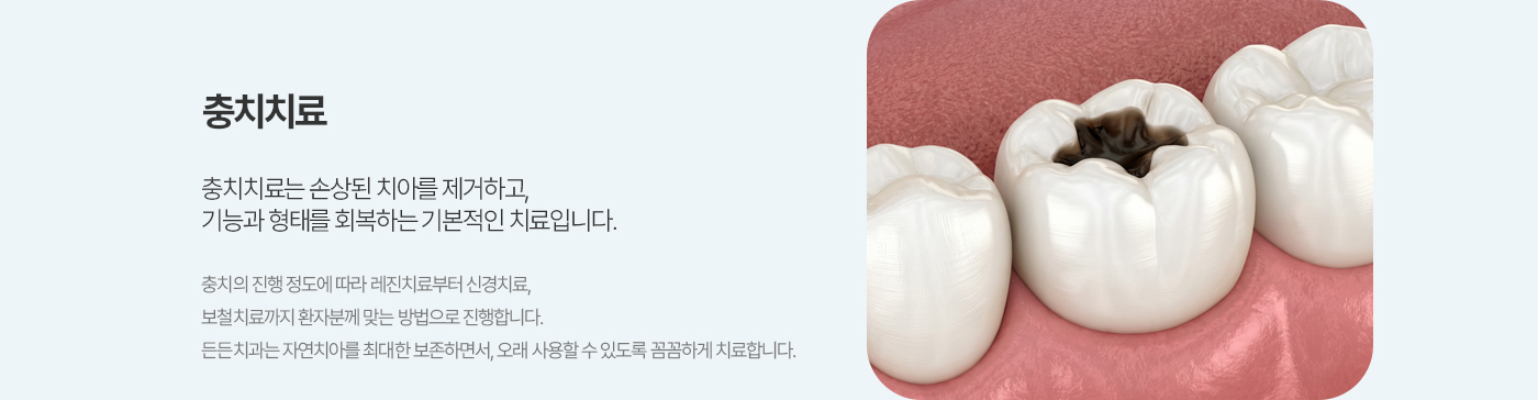충치치료