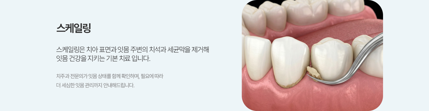 스케일링